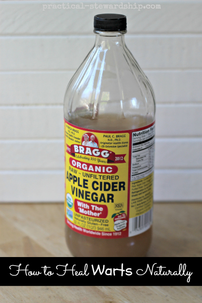 How to Heal Warts Naturally with Apple Cider Vinegar